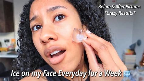 icing face results|I iced my face every day for three weeks – my skin has never  .